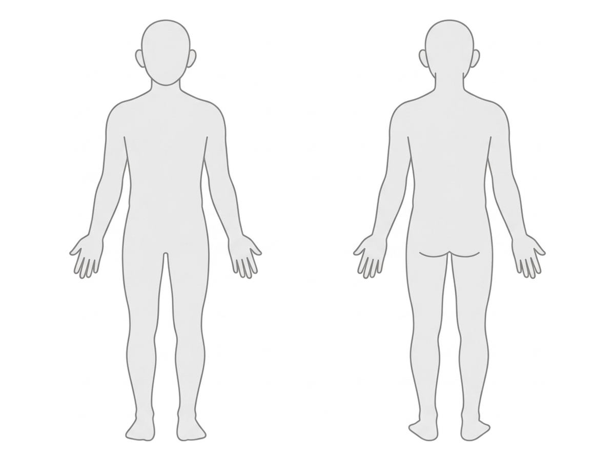 켈로이드가 자주 생기는 부위를 표시한 정면·후면 인체 선화