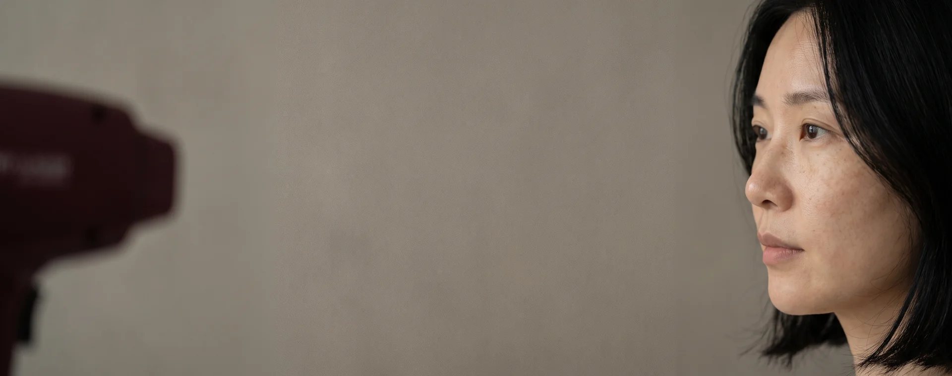 Ruby Laser consultation and treatment information